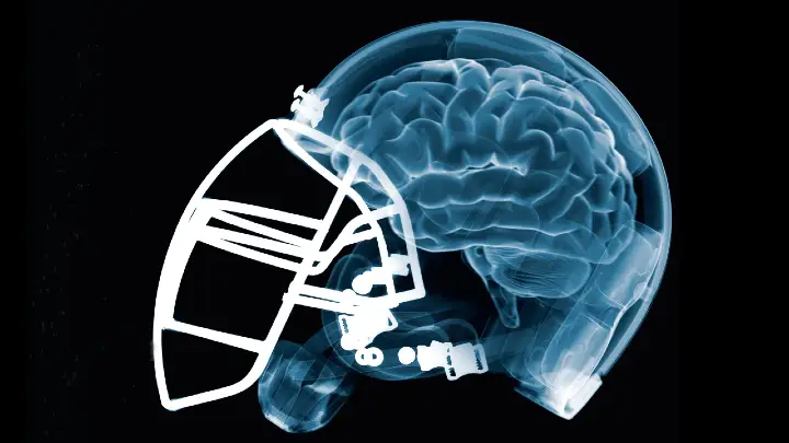 football brain injuries