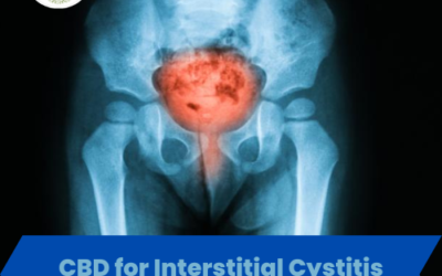 CBD oil for interstitial cystitis: What you need to know