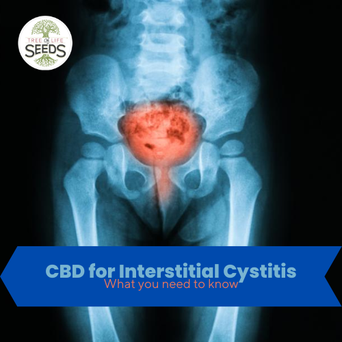 CBD oil for interstitial cystitis: What you need to know